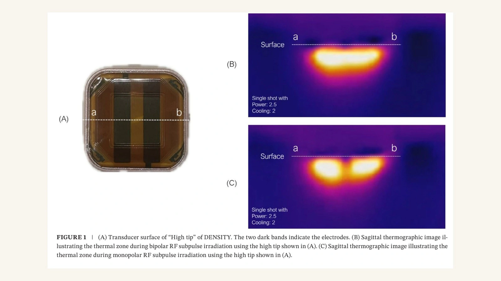 論文の図:デンシティのチップの電極面と、バイポーラーRFとモノポーラーRFで生じる熱の領域を示したサーモグラフィの断面