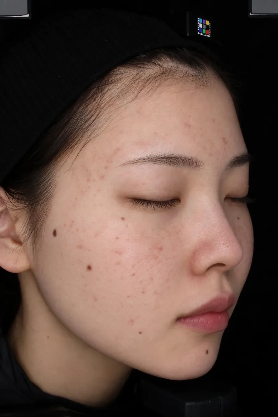 通常の光で撮ったカラー写真。頬の色ムラやそばかす、毛穴までそのままの色で写っている横顔